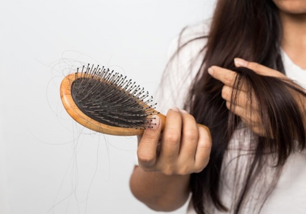 10 thực phẩm giúp ngăn ngừa chứng rụng tóc